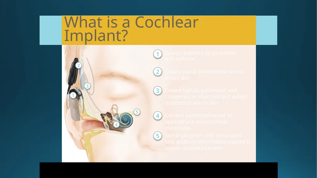 The Audiology Conundrum Audiological Pathways - slide 27 of 45