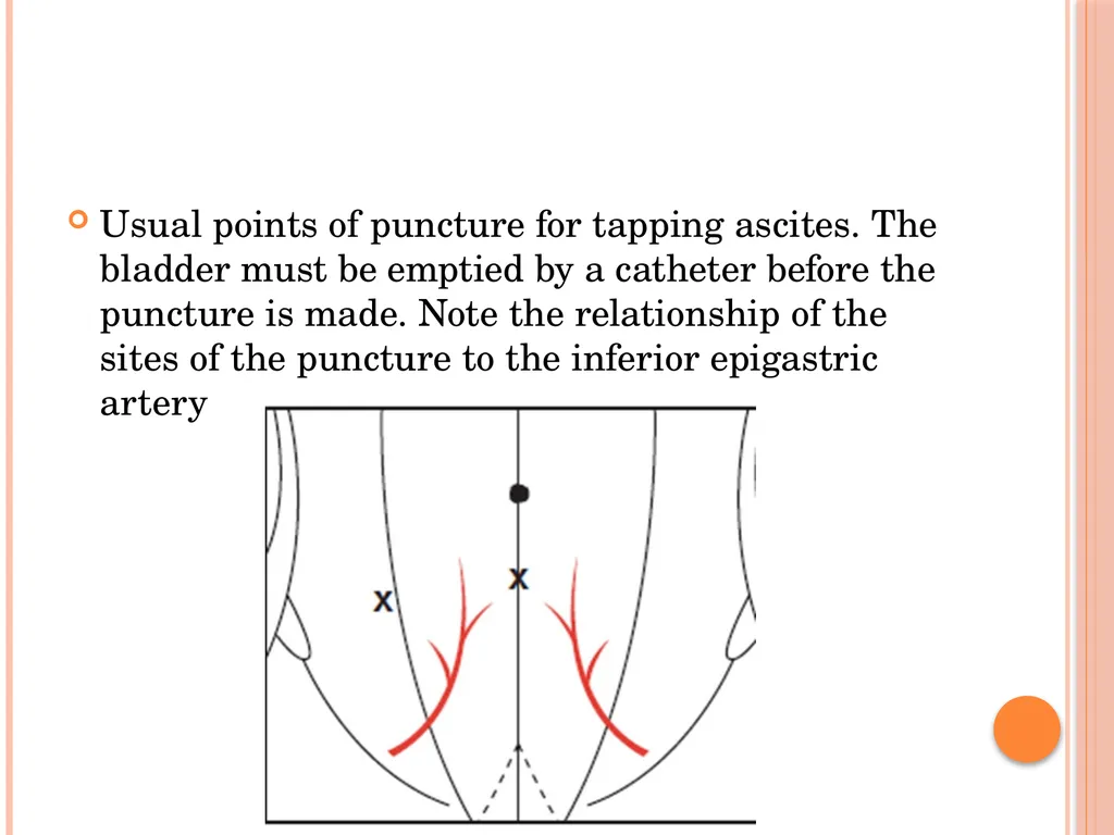 Abdominal and pelvic abscesses Abscess formation - slide 31 of 31