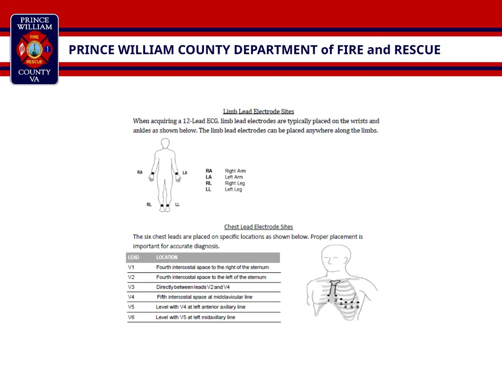 BLS Assist & Medic Unit Operations Lifepak 15 This - slide 5 of 17