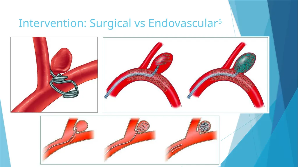 Cervical Spondylosis: A Case Study Leslie Rainey - slide 11 of 18