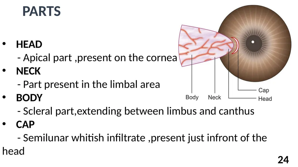 अर्म Dr Adeeb A ASST PROFESSOR Shalakyatantra - slide 24 of 33