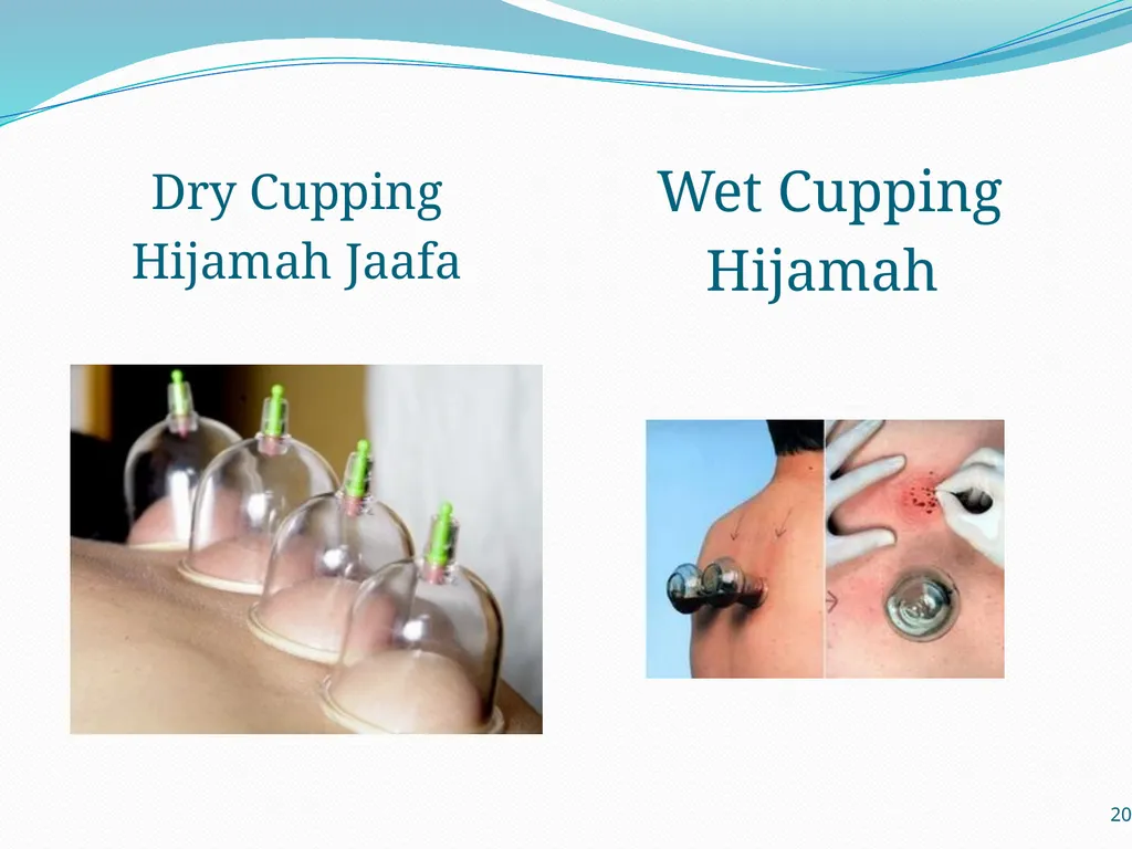 بِسْمِ اللَّهِ الرَّحْمَنِ الرَّحِيمِ Al-Hijamah - slide 20 of 24
