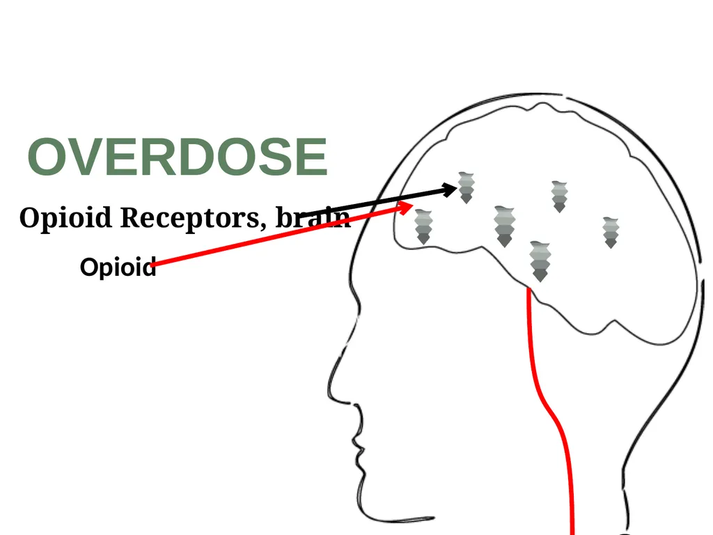 Overdose Response Training Dave Morgan, RPh Safe - slide 10 of 36
