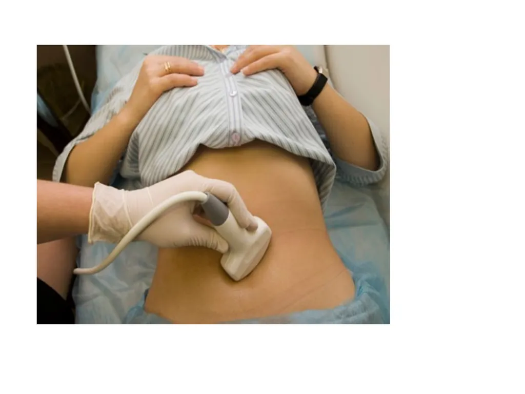 Endometriosis Dr Fulufhelo Tshivhula Specialist - slide 33 of 71