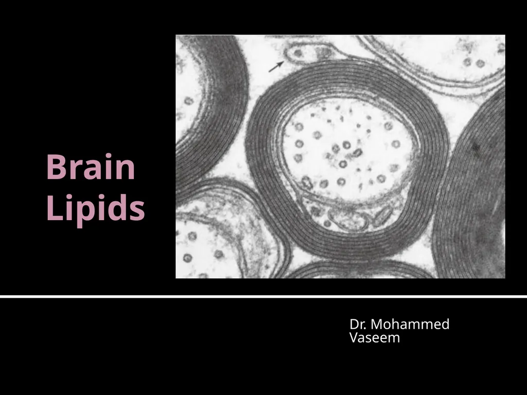 Brain Lipids Dr. Mohammed Vaseem Classification of - slide 1 of 23