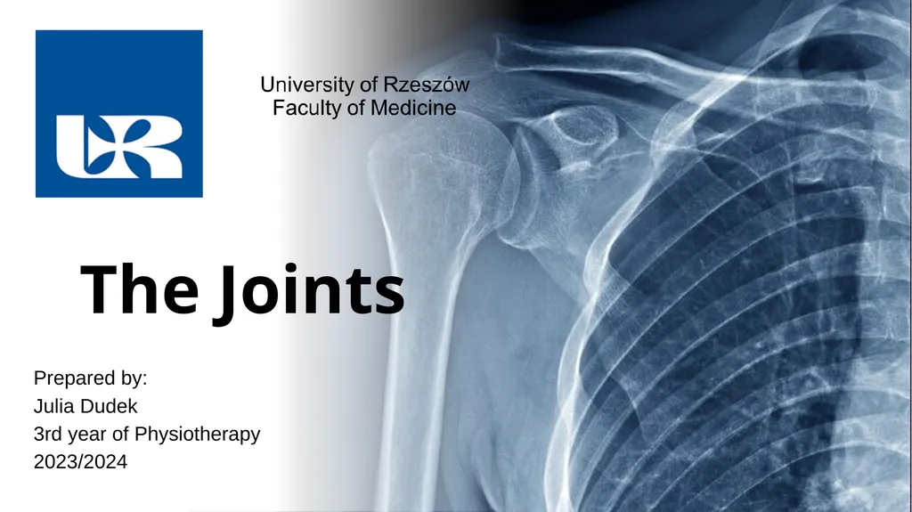 The Joints Prepared by: Julia Dudek 3rd year of - slide 1 of 17