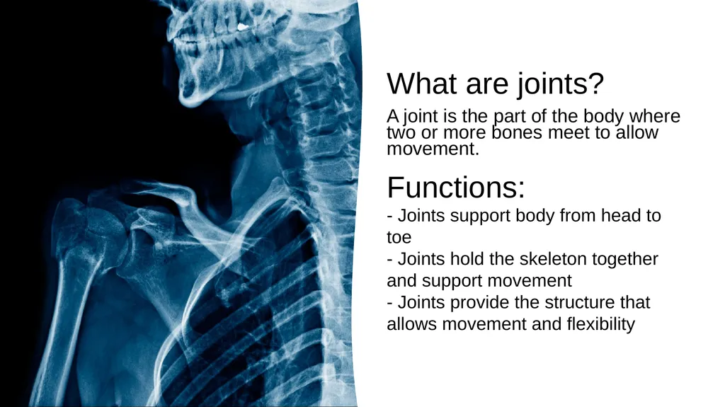The Joints Prepared by: Julia Dudek 3rd year of - slide 2 of 17