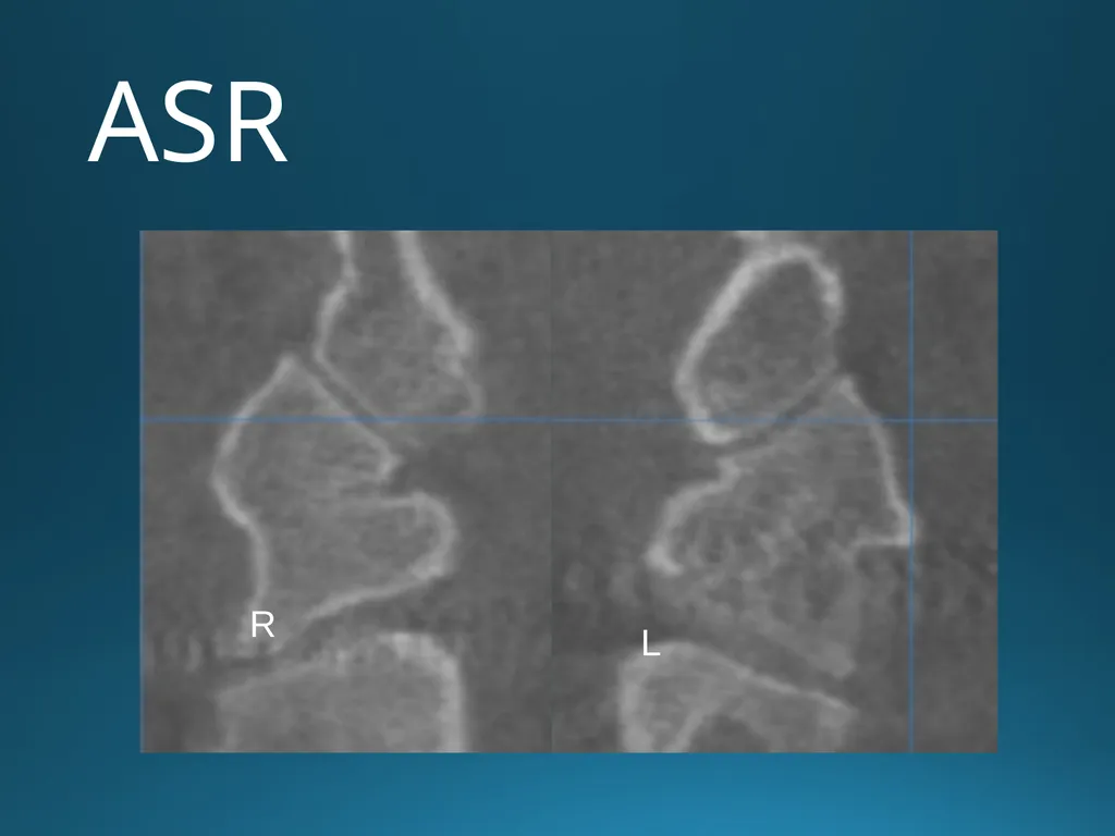 Blair Upper Cervical Research Hour 3 Blair - slide 10 of 40