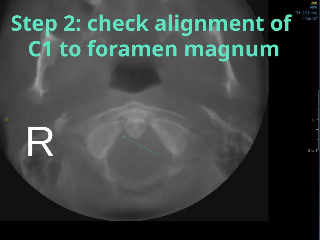 Blair Upper Cervical Research Hour 3 Blair - slide 9 of 40