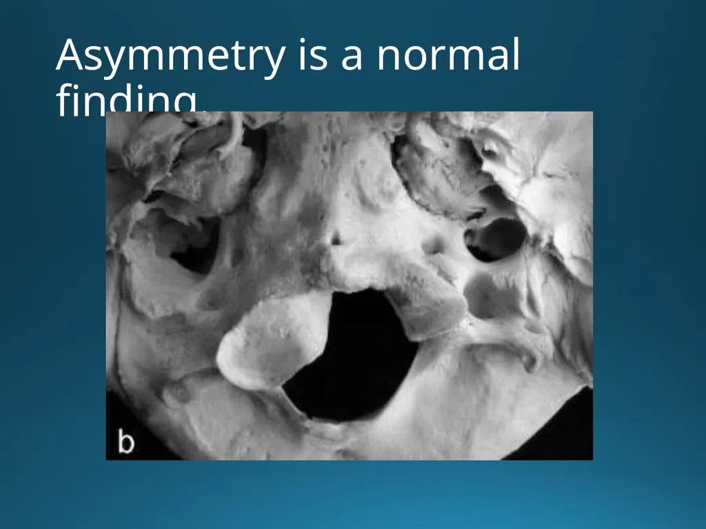 Blair Upper Cervical Research Hour 3 Blair - slide 6 of 40
