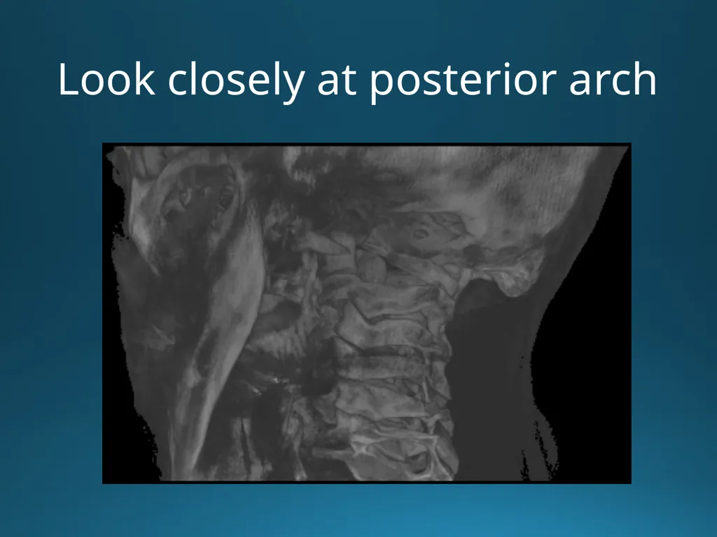 Blair Upper Cervical Research Hour 3 Blair - slide 7 of 40