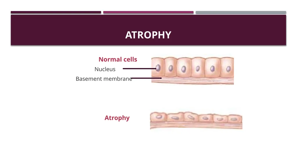 Cellular adaptation and cellular injury Prof. Dr. - slide 4 of 25