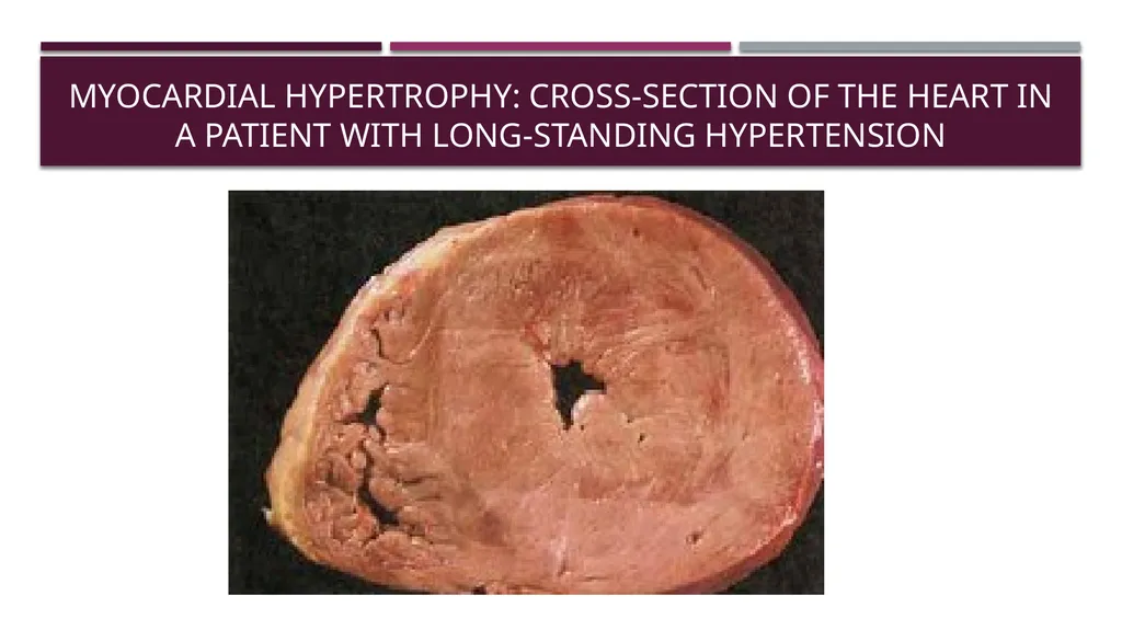 Cellular adaptation and cellular injury Prof. Dr. - slide 6 of 25