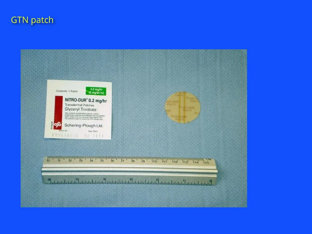 RAPID INTERVENTION WITH GTN IN HYPERACUTE STROKE - slide 12 of 28