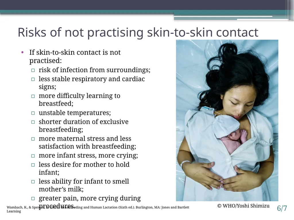 Session 6. Impact of birth practices 6/1 © - slide 7 of 14