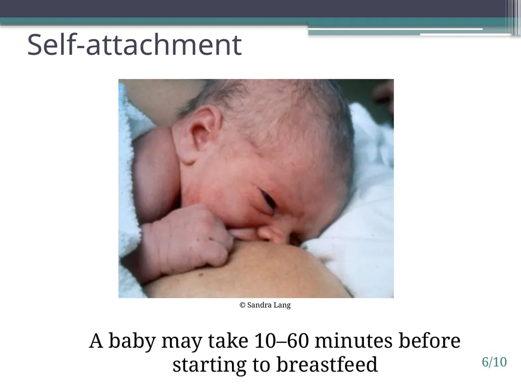 Session 6. Impact of birth practices 6/1 © - slide 10 of 14