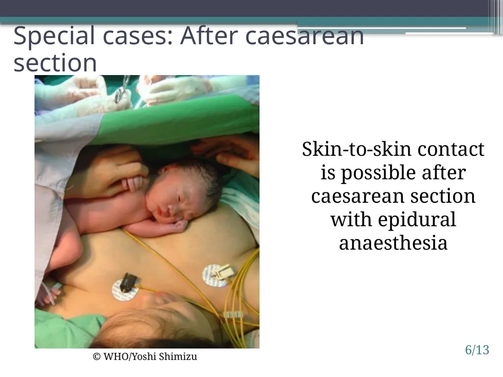 Session 6. Impact of birth practices 6/1 © - slide 13 of 14