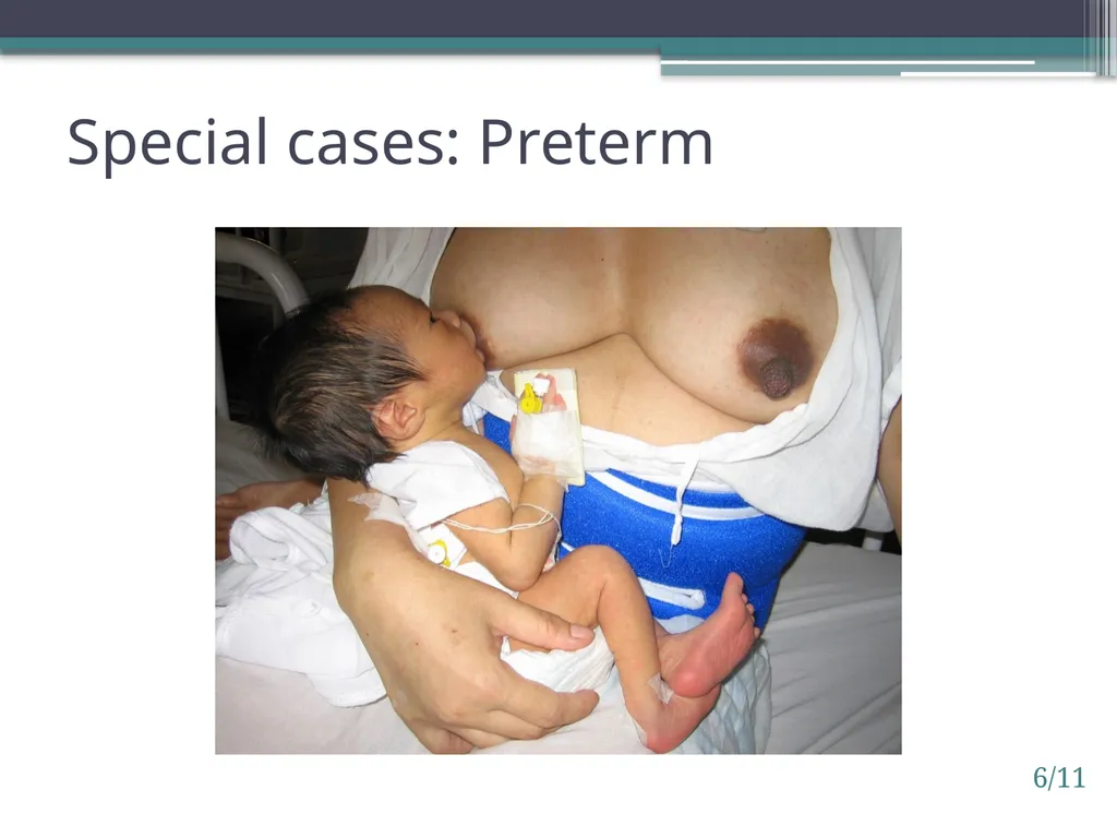 Session 6. Impact of birth practices 6/1 © - slide 11 of 14