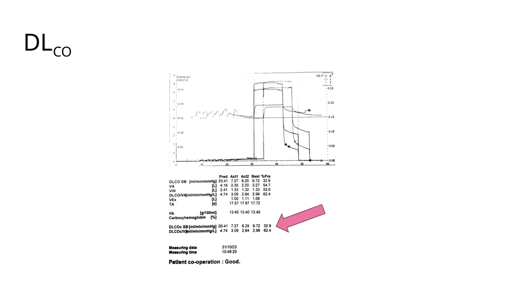 Diffusing Capacity of the Lung for Carbon Monoxide - slide 2 of 26