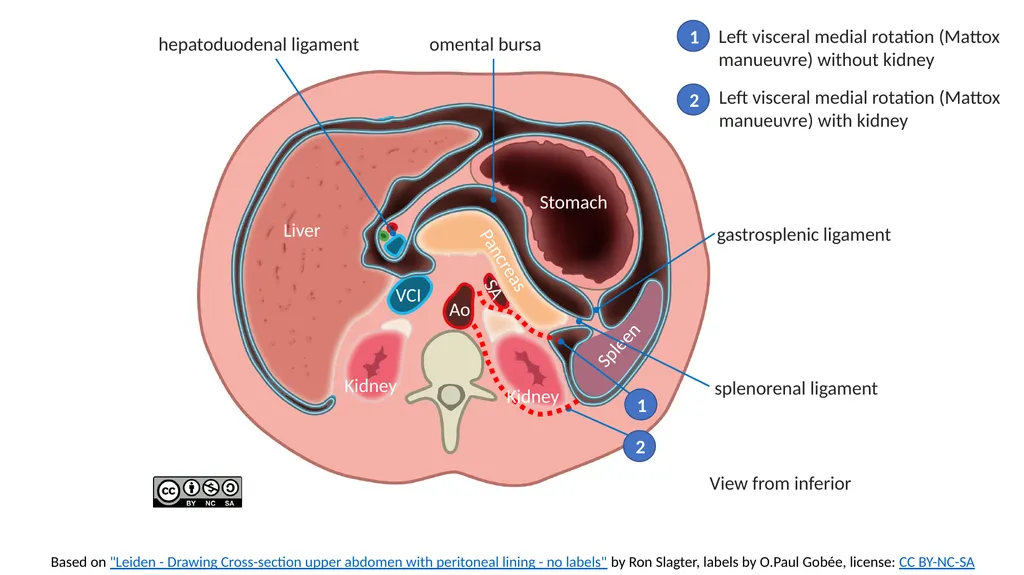 Based on "Leiden - Drawing Cross-section upper - slide 4 of 4