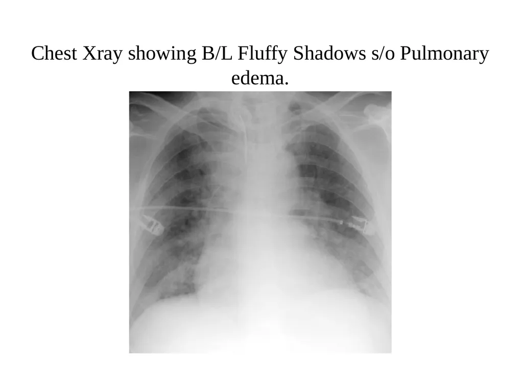 Common presentation of a relatively Uncommon - slide 6 of 20
