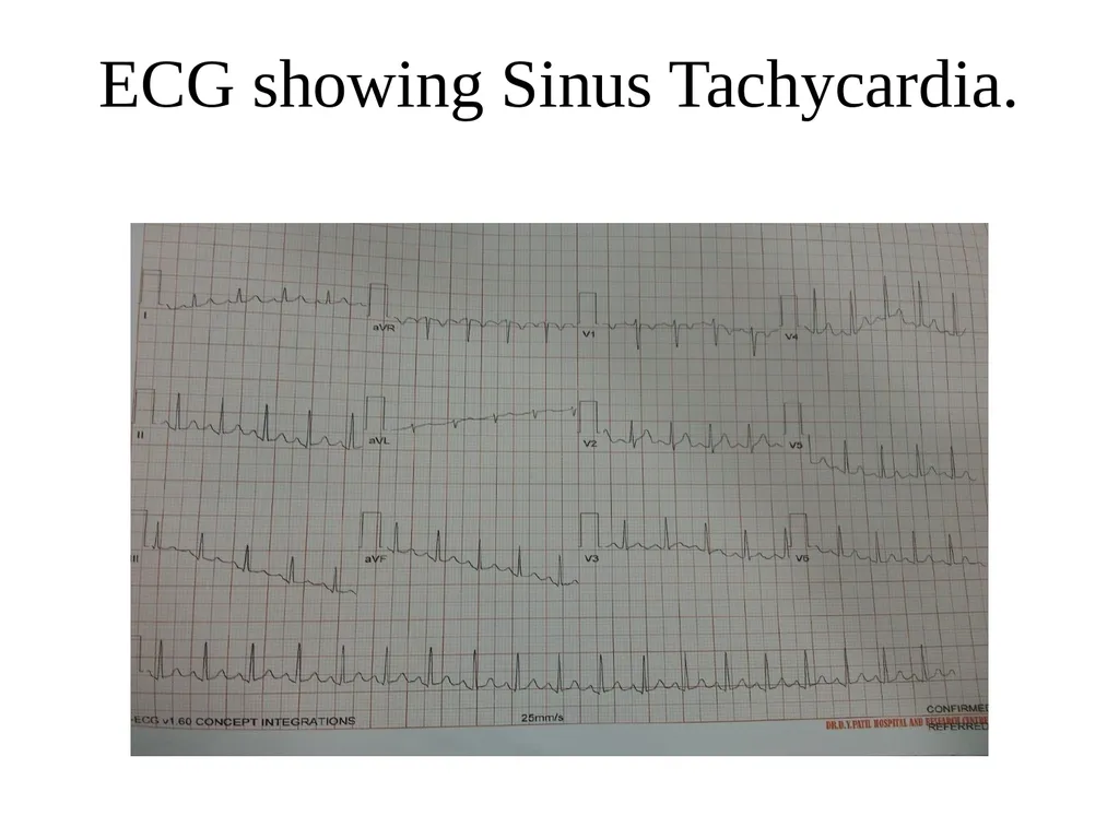 Common presentation of a relatively Uncommon - slide 7 of 20