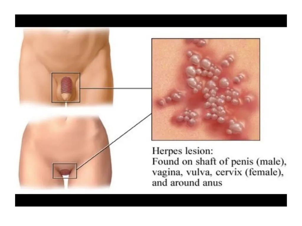 Promoting Fetal & Maternal Health By: Assist.Prof - slide 35 of 45