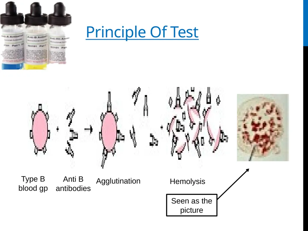 ABO Blood & Rh Grouping system Lab# 3 BCH 471 - slide 15 of 16