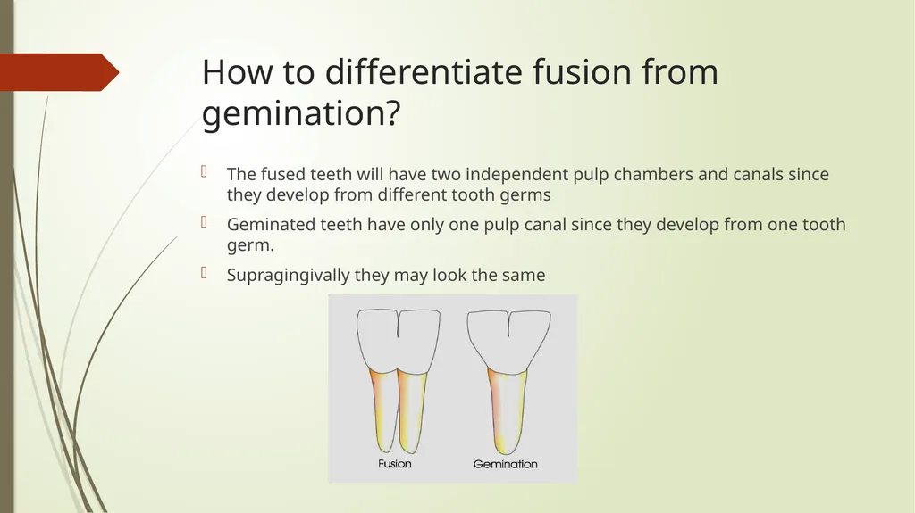 Tooth Fusion By Bushra Meraj Histology & - slide 4 of 9