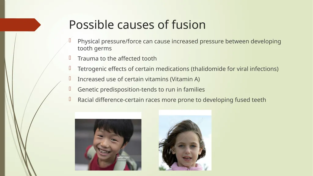 Tooth Fusion By Bushra Meraj Histology & - slide 5 of 9
