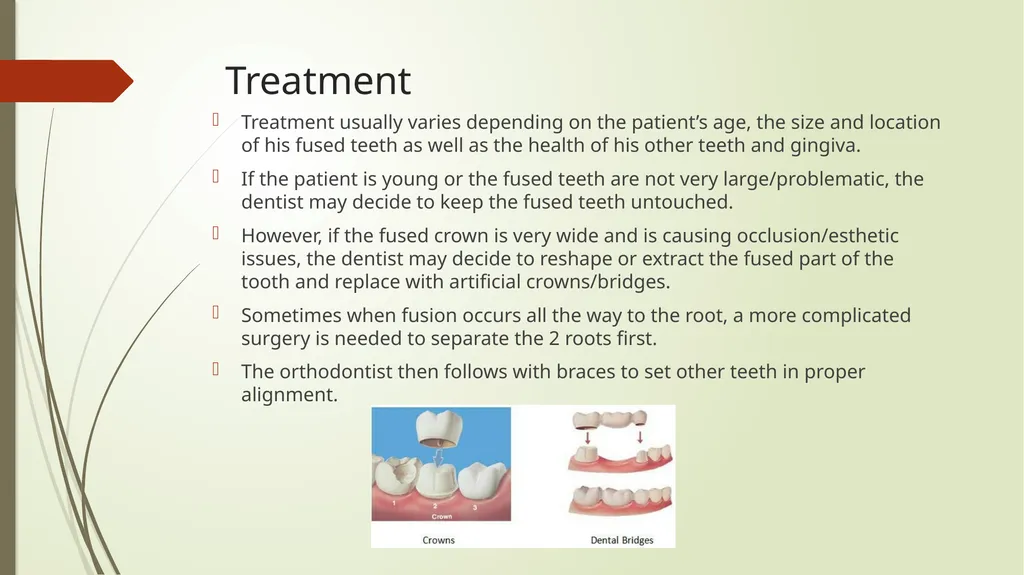 Tooth Fusion By Bushra Meraj Histology & - slide 7 of 9
