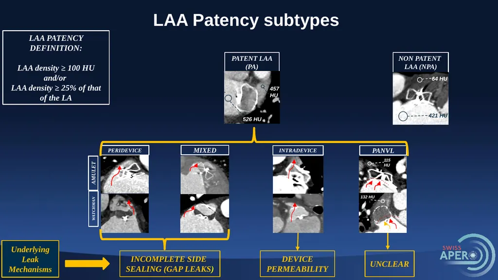 One-Year Outcomes after Amulet or Watchman/FLX - slide 7 of 15