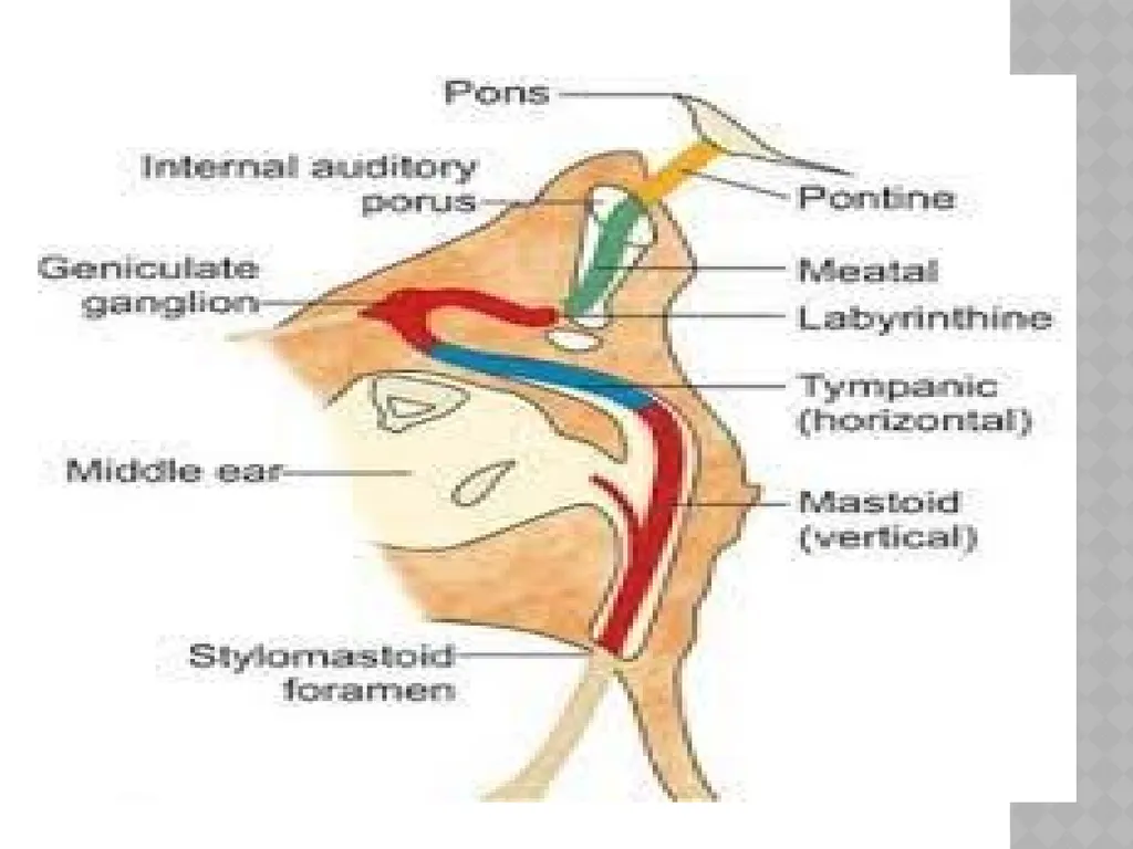 FACIAL NERVE PLASY Dr.Satguru Saran Singh - slide 13 of 53