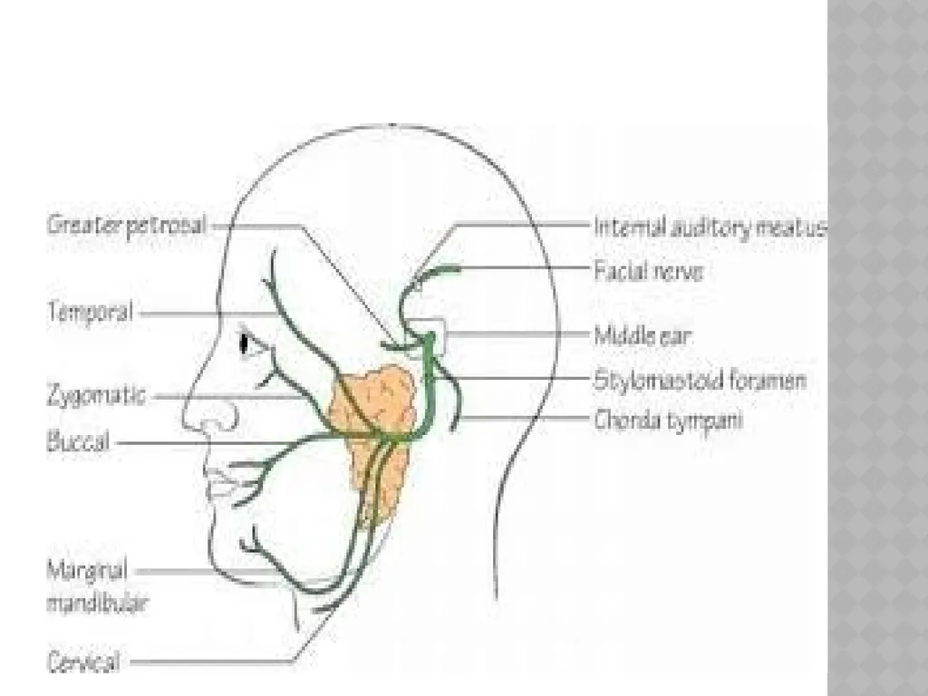 FACIAL NERVE PLASY Dr.Satguru Saran Singh - slide 16 of 53