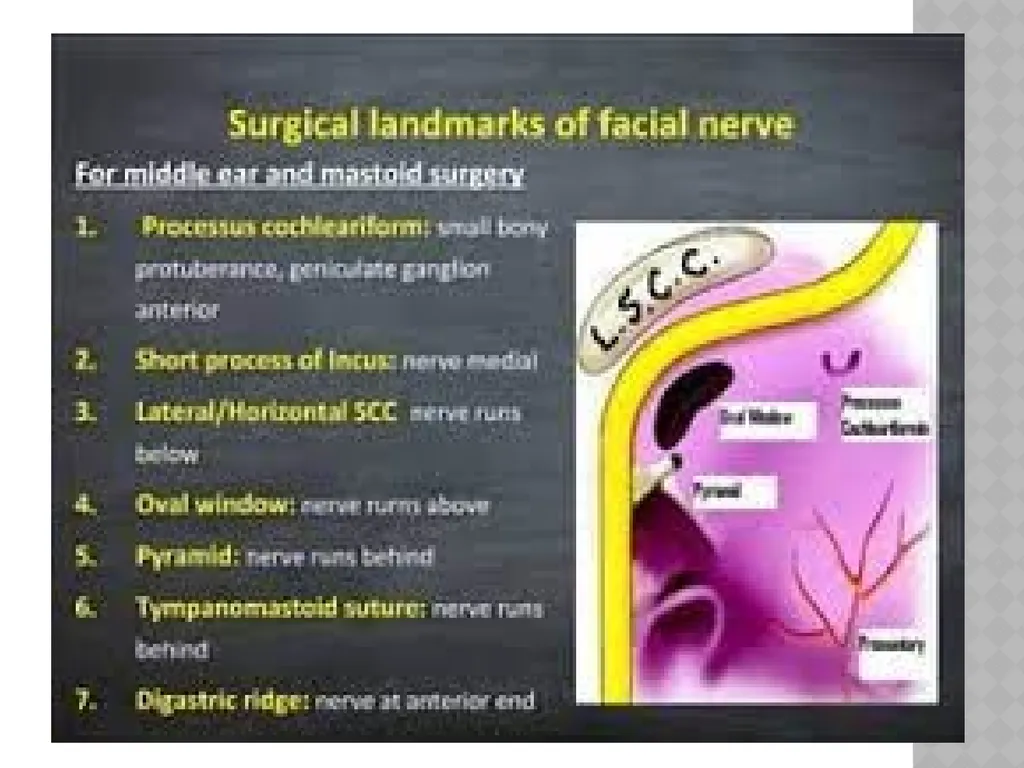 FACIAL NERVE PLASY Dr.Satguru Saran Singh - slide 22 of 53