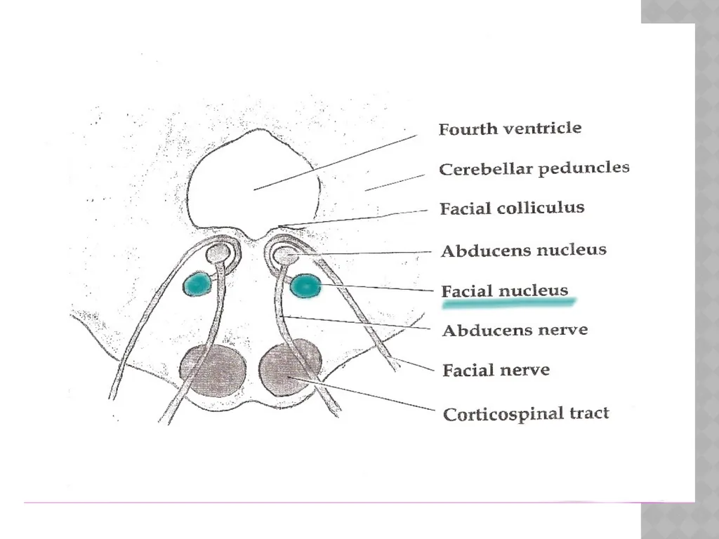 FACIAL NERVE PLASY Dr.Satguru Saran Singh - slide 7 of 53