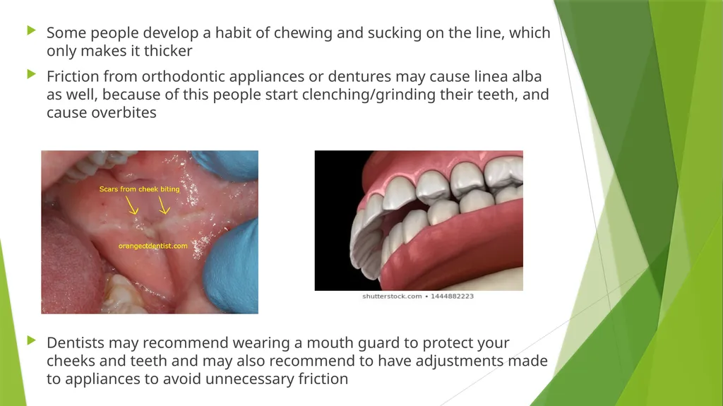 Fordyce Granules (Spots) & Linea Alba Denise - slide 5 of 6