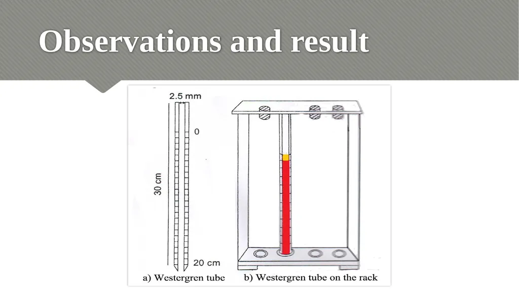 ERYTHROCYTE SEDIMENTATION RATE (ESR) Relevance - slide 21 of 24
