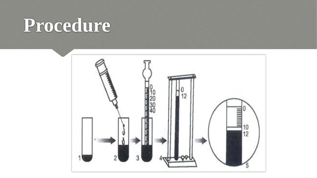 ERYTHROCYTE SEDIMENTATION RATE (ESR) Relevance - slide 18 of 24