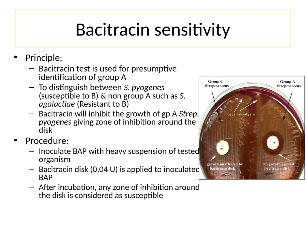 Streptococci assist. Prof. Zainab Abdul jabar - slide 17 of 32