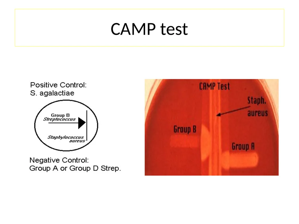 Streptococci assist. Prof. Zainab Abdul jabar - slide 19 of 32