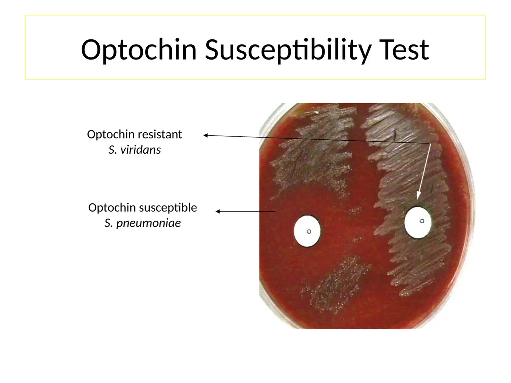 Streptococci assist. Prof. Zainab Abdul jabar - slide 21 of 32