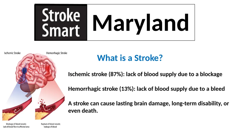 Spot a Stroke Stop a Stroke Save a Life A - slide 2 of 16