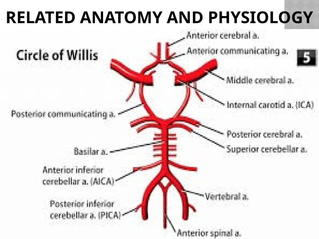 Cerebro VASCULAR ACCIDENT(CVA) / STROKE - slide 6 of 19