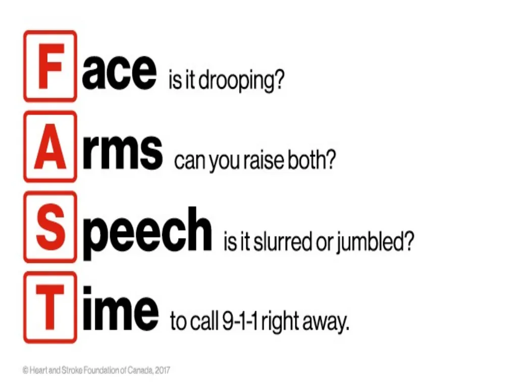Cerebro VASCULAR ACCIDENT(CVA) / STROKE - slide 12 of 19