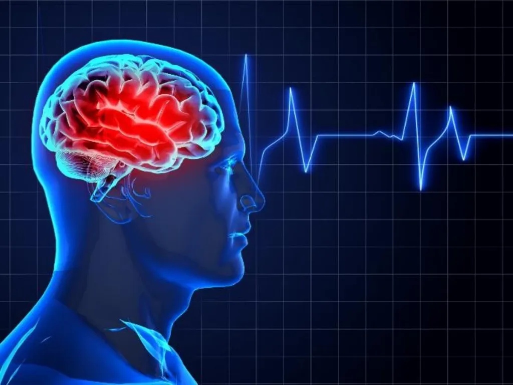 Cerebro VASCULAR ACCIDENT(CVA) / STROKE - slide 19 of 19