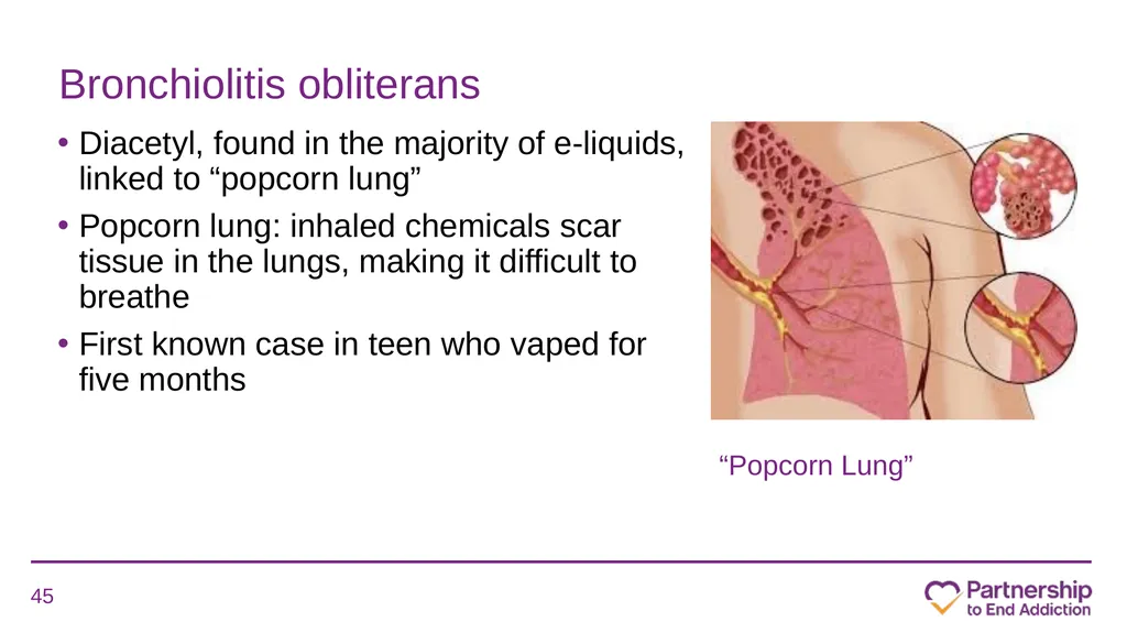 Juuling, Dripping, Dabbing and More: What School - slide 45 of 63