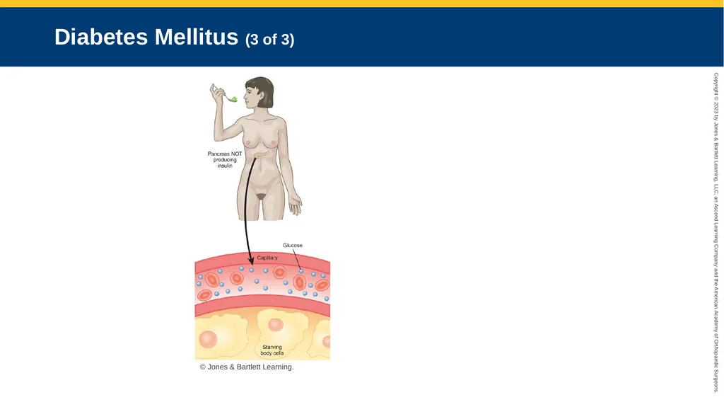 Endocrine Emergencies CHAPTER 24 Introduction - slide 36 of 102