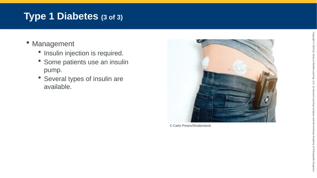 Endocrine Emergencies CHAPTER 24 Introduction - slide 42 of 102