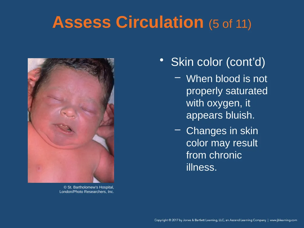 Chapter 9 Patient Assessment National EMS - slide 60 of 177